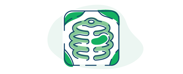 illustration of a chest x-ray