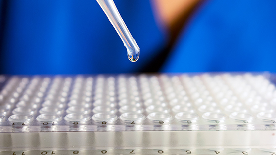 An eye dropper with liquid being placed into one of the many test tubes that are grouped.