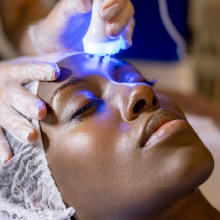 Patient receiving blue light therapy during a cosmetic dermatology procedure to improve skin texture and reduce acne.